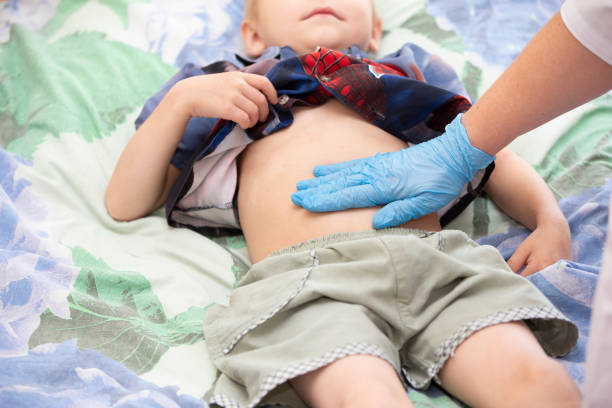 Appendix Surgery for Children | Best Pediatric Surgeon in Faridabad